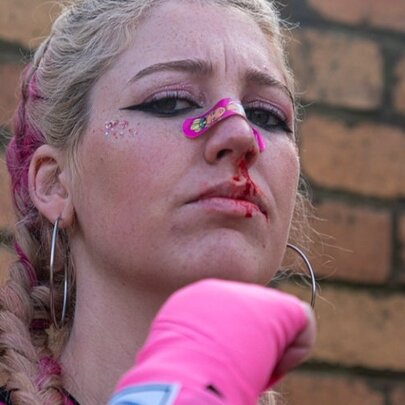 Bella Noonan: You Should See the Other Guy