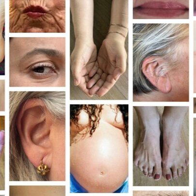 Stories from the Body