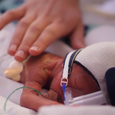 A tiny premature baby in the Neonatal Intensive Care Unit with an adult's hand very lightly touching their back.