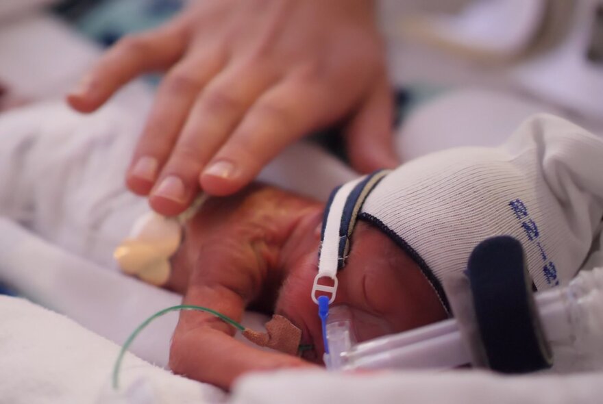 A tiny premature baby in the Neonatal Intensive Care Unit with an adult's hand very lightly touching their back.