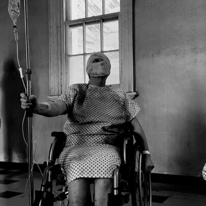 Black and white still from the movie Cerebral Organoid depicting a surreal or staged hospital scene with figures wrapped in hospital gowns, their faces covered in bandages, one in a wheelchair attached to a drip and another walking around in the space.