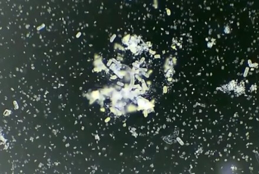 Micro-organisms against a black background.