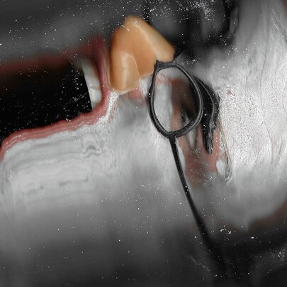 A distorted and elongated face that is covered in white paint or foam, their mouth is wide open, the nose looks like a fake prosthetic and they wear glasses.